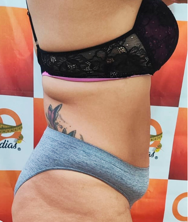 Depois